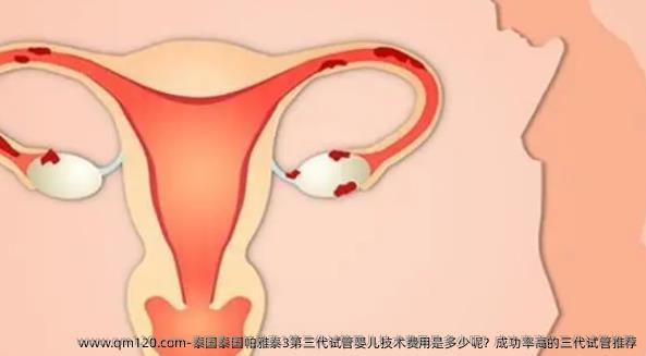 泰国泰国帕雅泰3第三代试管婴儿技术费用是多少呢？成功率高的三代试管推荐
