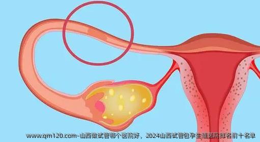 山西做试管哪个医院好，2024山西试管包孕生殖医院排名前十名单