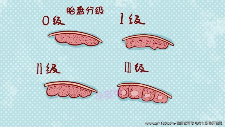 泰国试管婴儿的全部费用预算