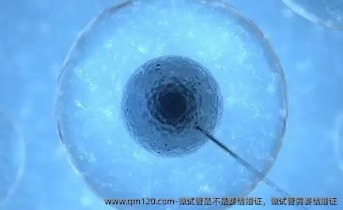 做试管是不是要结婚证，做试管需要结婚证