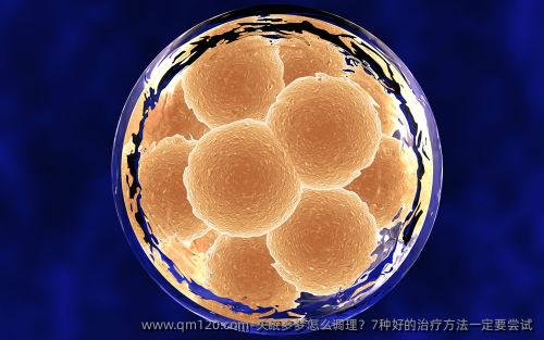 失眠多梦怎么调理？7种好的治疗方法一定要尝试