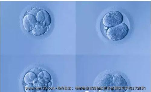 热点直击：揭秘提高宫腔粘连患者试管成功率的3大诀窍！