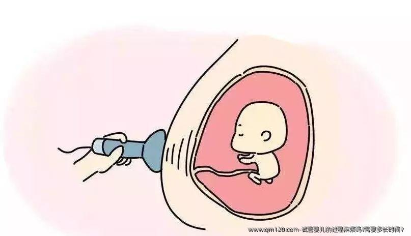 ‌试管婴儿的过程麻烦吗?需要多长时间？