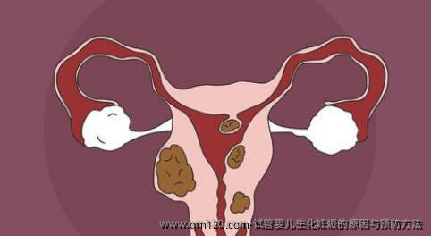 试管婴儿生化妊娠的原因与预防方法