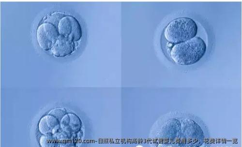 日照机构高龄3代试管婴儿费用多少，花费详情一览