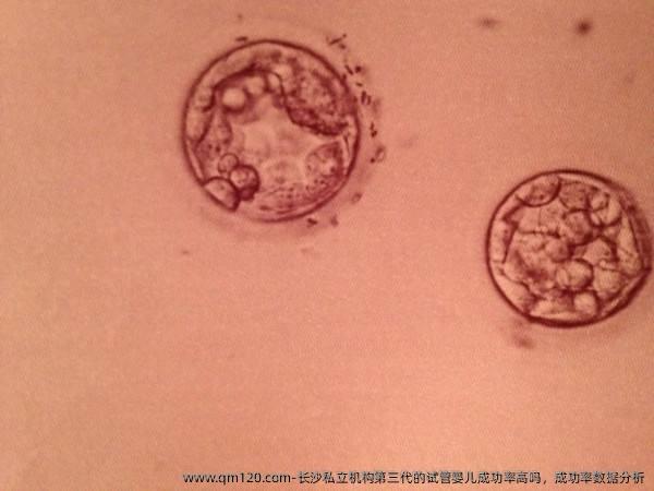 长沙机构第三代的试管婴儿成功率高吗，成功率数据分析