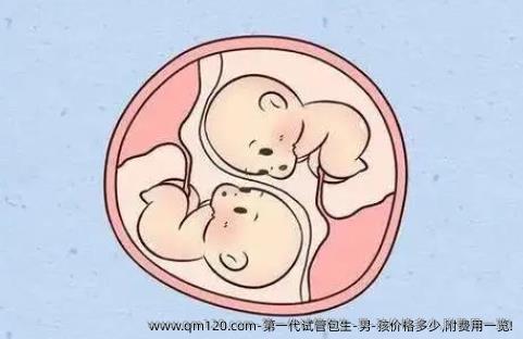 第一代试管**-男-孩价格多少,附费用一览!