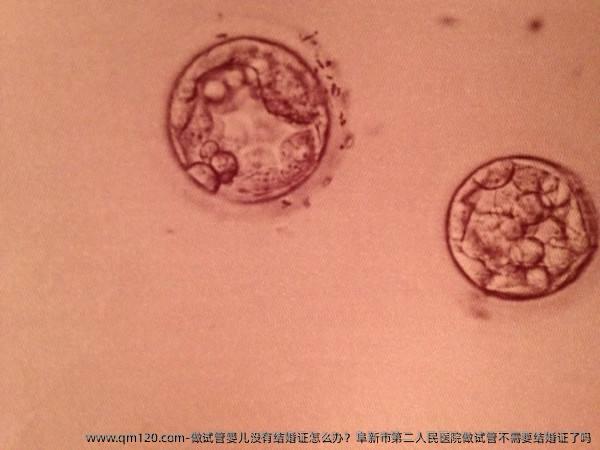 做试管婴儿没有结婚证怎么办？阜新市第二人民医院做试管不需要结婚证了吗