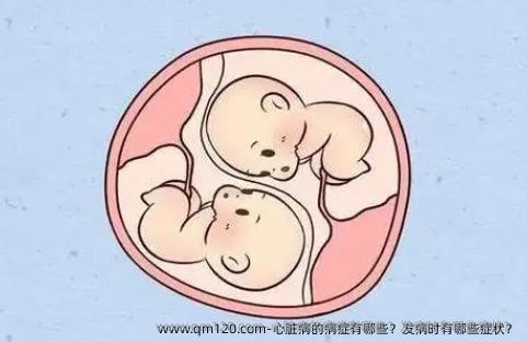 心脏病的病症有哪些？发病时有哪些症状？