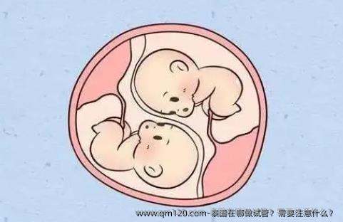 泰国在哪做试管？需要注意什么？