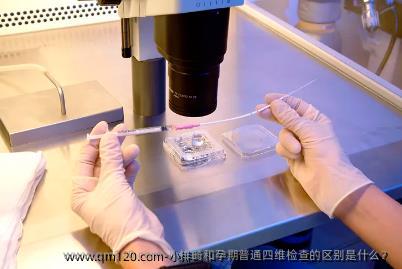 小排畸和孕期普通四维检查的区别是什么?