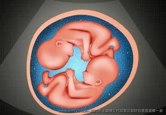 2025年上海做三代试管比较好的医院是哪一家