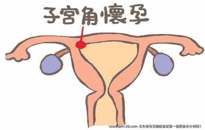 丈夫患有无精症做试管一般需要多少时间?