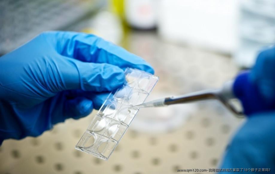 我用拮抗剂短方案取了18个卵子正常吗?