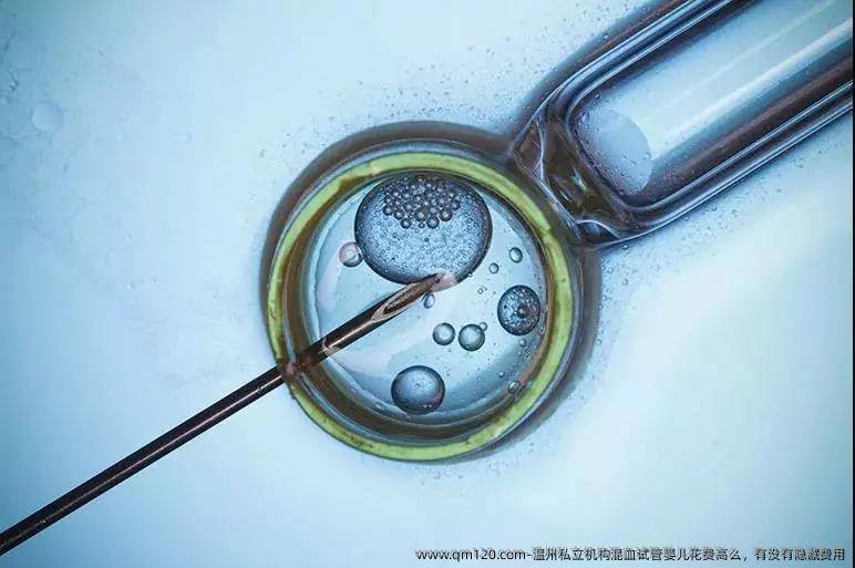 温州私立机构混血试管婴儿花费高么，有没有隐藏费用