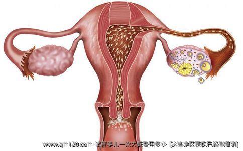 试管婴儿一次大概费用多少  [这些地区医保已经能报销]