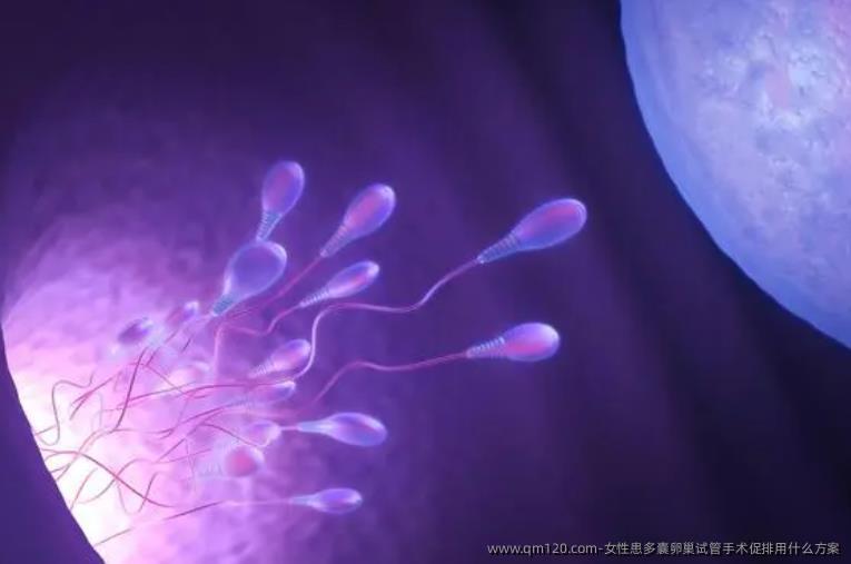 女性患多囊卵巢试管手术促排用什么方案