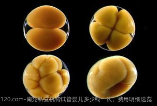 南充私立机构试管婴儿多少钱一次，费用明细速览