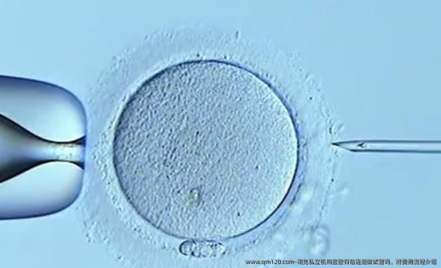 南充私立机构宫腔有粘连能做试管吗，附费用流程介绍