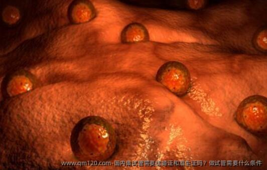 国内做试管需要结婚证和准生证吗?做试管需要什么条件