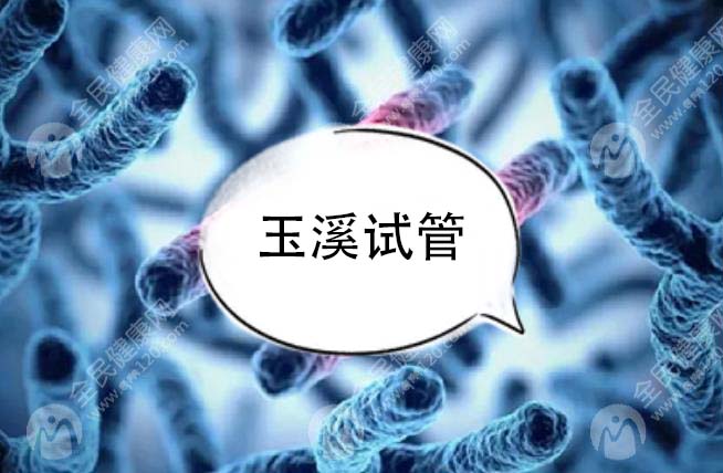 玉溪试管