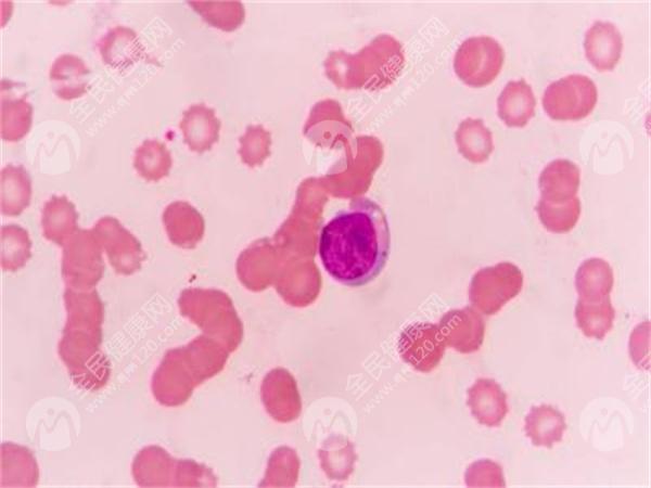 子宫内膜7mm可以做试管移植吗？调节子宫内膜厚度的方法