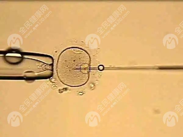 南充哪里可以做试管婴儿试管宝宝可以健康成长吗