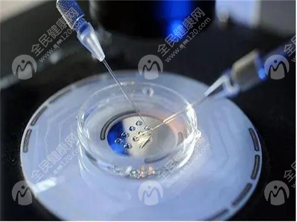 临沂试管婴儿较好的医院是哪个？试管婴儿如何快速怀宝宝？