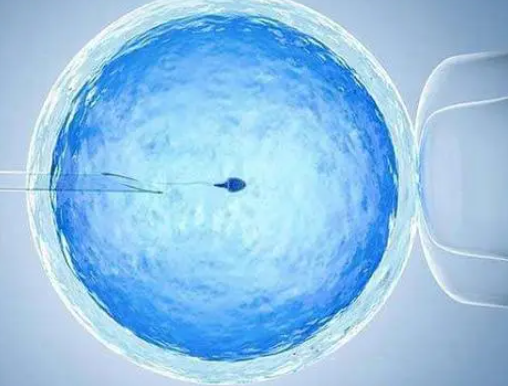 试管移植不会进行方案筛选