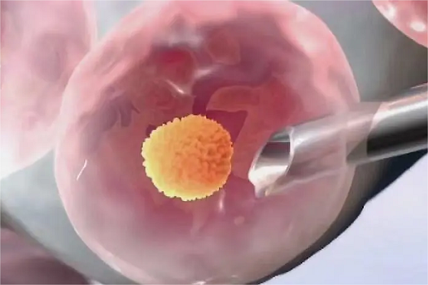 年龄越大取到的卵子数量就越少