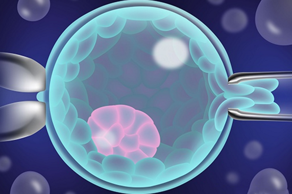 2025年精子畸形去捷克布拉格做试管的全部流程,从检查到移植每一步都很详细