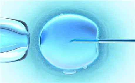 2025年无结婚证在淄博市妇幼         做三代试管的费用高吗？费用详细介绍