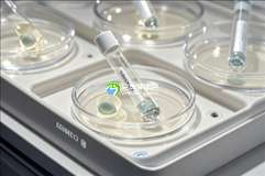 2025年去没有精子印度孟买做精子试管可以吗？成功率有多高？