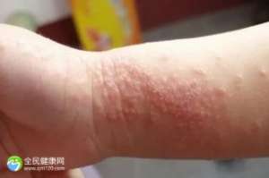 【成都试管生子医院能一次便能成功吗】