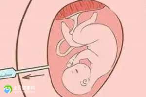 【佛山试管比较好的医院排名前十名】