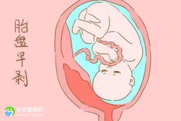 治疗卵巢早衰的4款中药偏方，中医食疗对比药疗效果